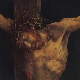 北方文藝復興的著名傑作，艾森漢姆祭壇畫(Isenheim Altarpiece, 1506-1515)中的耶穌像。畫家繪畫耶穌時，把當時農民常見的嚴重皮膚病畫在耶穌身上。